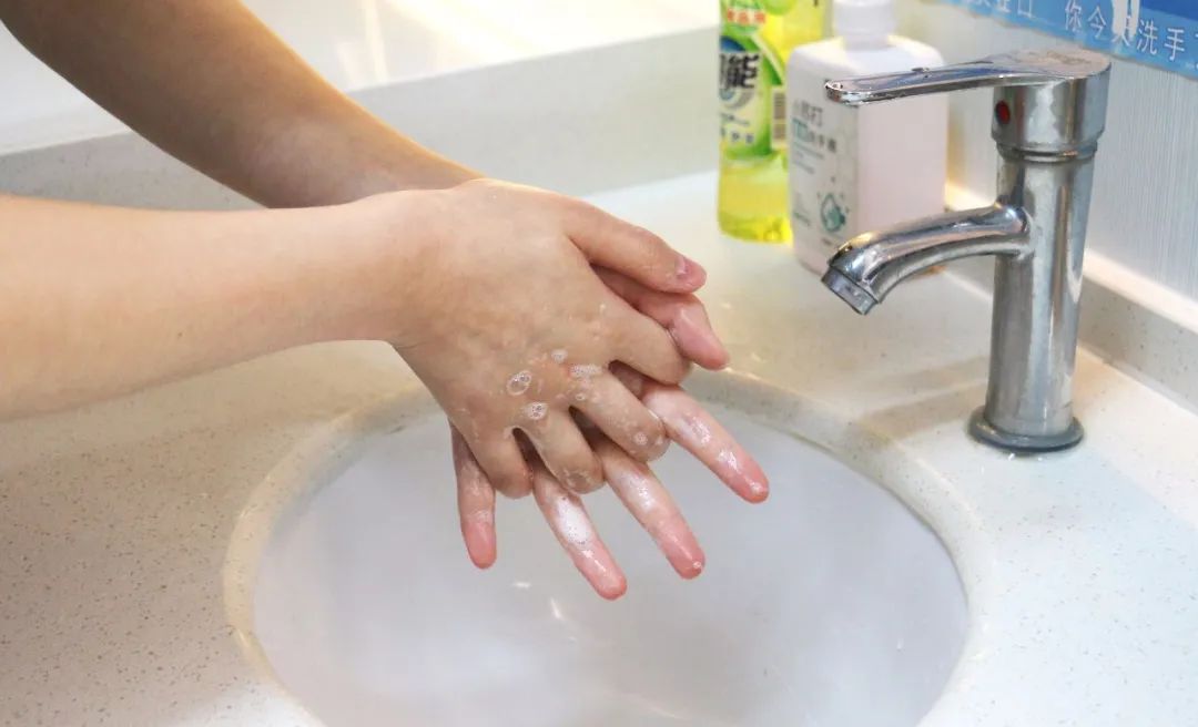 疫情期間做完近視手術后如何防護？