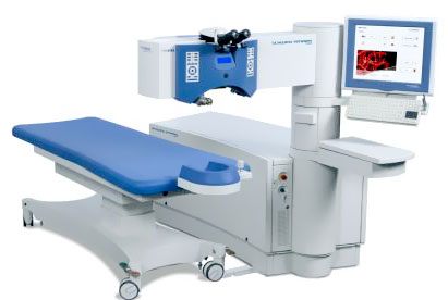 阿瑪仕準(zhǔn)分子激光